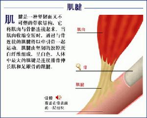 （圖）肌肉肌腱單位的急性損傷