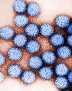 輪狀病毒 輪狀病毒