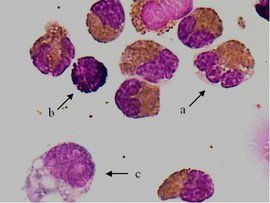 嗜酸粒細胞 嗜酸粒細胞