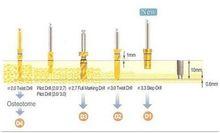 韓國奧齒泰種植系統