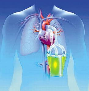 肺性腦病 肺性腦病