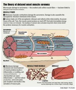 延遲性肌肉酸痛
