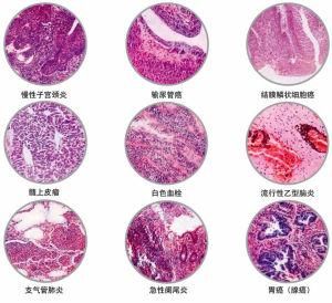 病理 病理