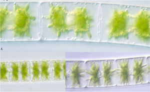 寧夏雙星藻 寧夏雙星藻