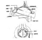 蝶竇惡性腫瘤 蝶竇惡性腫瘤