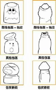 假性包皮過長 假性包皮過長