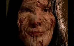 葉琳氏症 葉琳氏症