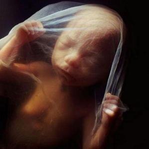 胎兒寫真 胎兒寫真