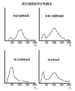 尿紅細胞容積分布曲線 尿紅細胞容積分布曲線