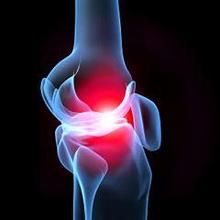 膝蓋關節炎發病部位