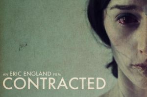 神秘感染 神秘感染