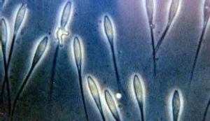 足孢蟲屬 足孢蟲屬