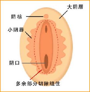 大小陰唇