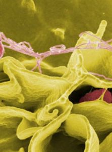 沙門氏菌 沙門氏菌