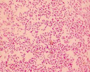 兼性細菌 兼性細菌