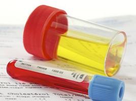 運動性血尿 運動性血尿