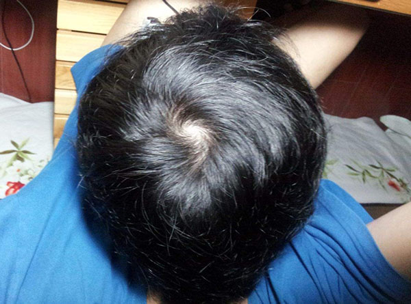 “一鏇軟,兩鏇橫,三鏇打架不要命”是真的嗎?