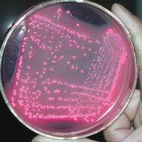 不典型O1群霍亂弧菌 不典型O1群霍亂弧菌