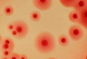 砂眼衣原體 砂眼衣原體