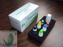 EB病毒Rta蛋白抗體IgG檢測試劑盒(酶聯免疫法) EB病毒Rta蛋白抗體IgG檢測試劑盒(酶聯免疫法)