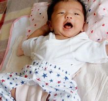 震顫型腦癱 震顫型腦癱