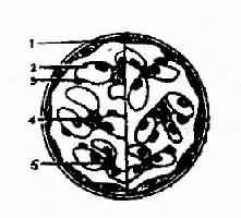 原發性腎小球腎炎