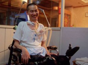 格林巴利綜合症