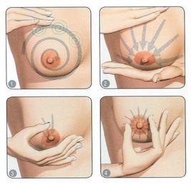 乳腺疾病診治 乳腺疾病診治