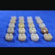 水晶鋯牙 水晶鋯牙