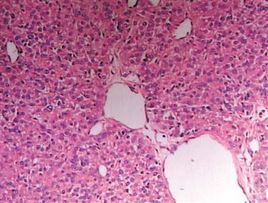 嗜鉻粒蛋白A 嗜鉻粒蛋白A