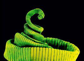 腦囊尾蚴病 腦囊尾蚴病