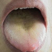 四季三黃片 四季三黃片