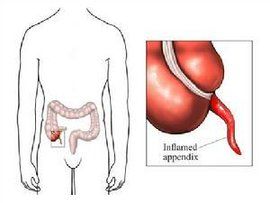 消化系統疾病 消化系統疾病