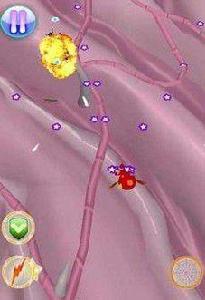 遠古侵襲 遠古侵襲