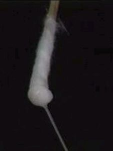 白帶發黃 白帶發黃