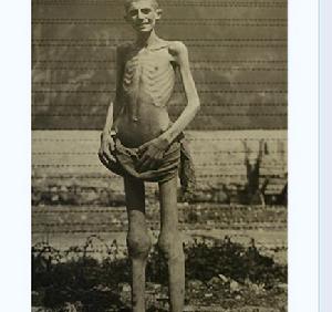 這是奧斯威辛集中營解放時的倖存者