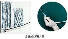 尿道支架 尿道支架