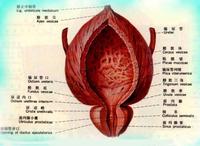 （圖）結核性膀胱自發破裂