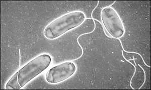 軍團菌肺炎 軍團菌肺炎