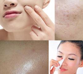 水油平衡 水油平衡