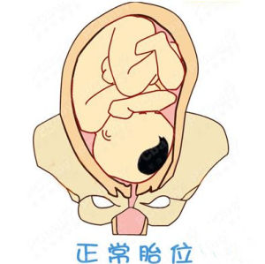 正常胎點陣圖示