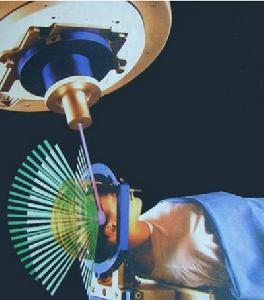 ct掃描診斷鼻咽癌