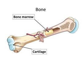 骨質破壞 骨質破壞