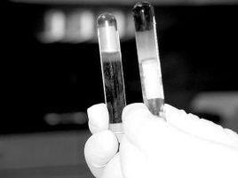 超強冷凝血 超強冷凝血