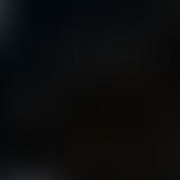 IC 1544 RASS 彩色圖