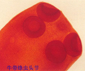 牛帶絛蟲病