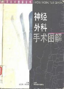 神經外科手術圖解 神經外科手術圖解