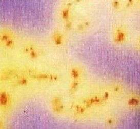 大腸菌群 大腸菌群