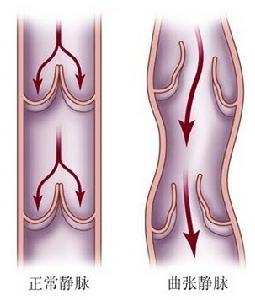 Surgilas德國微光無創免疫療法