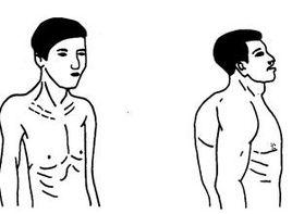 胸廓狹窄而扁 胸廓狹窄而扁